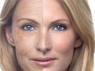 Teri pigmentatsiyasi